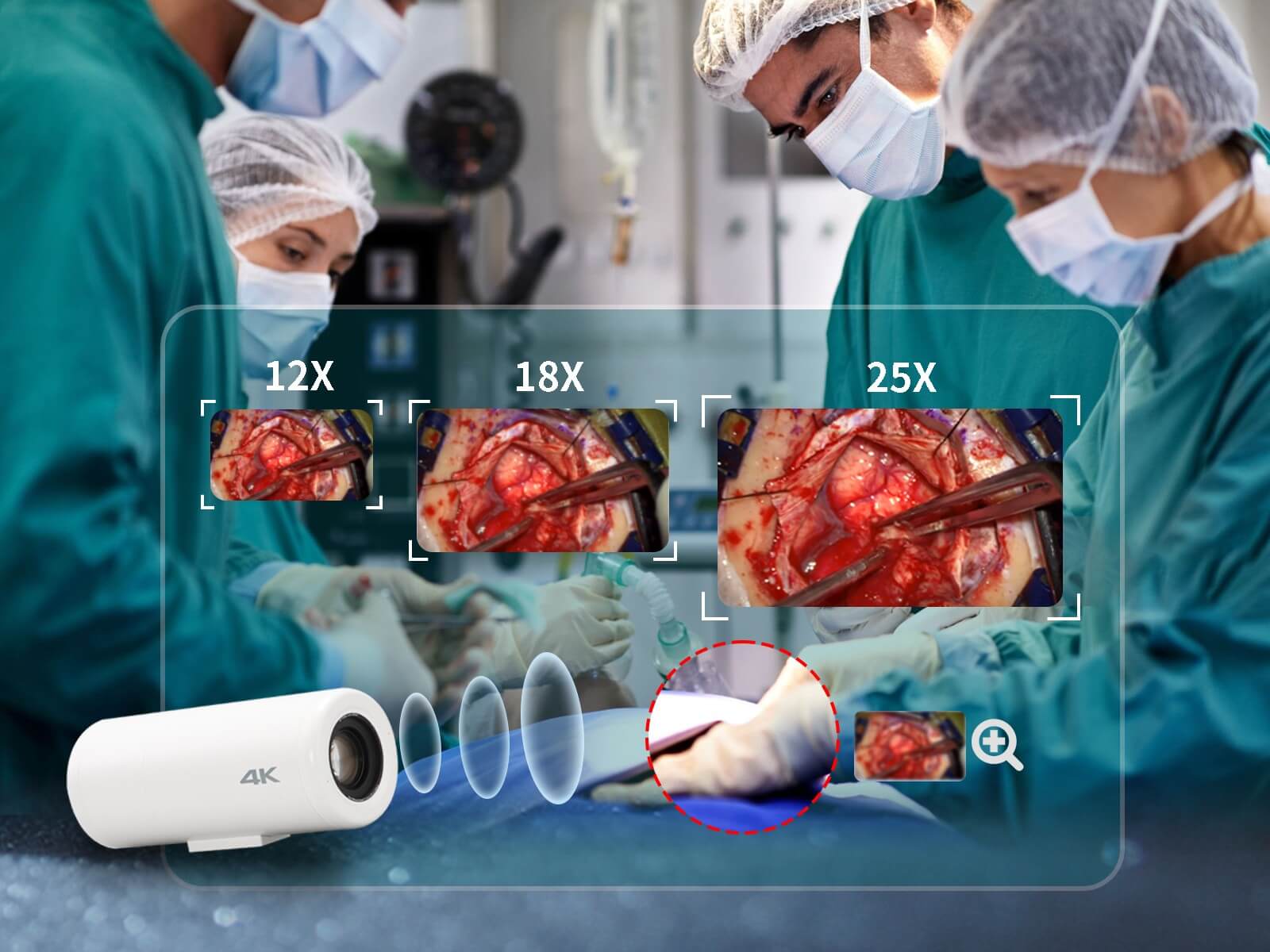 zowietek-4K-surgical-video-camera (10)
